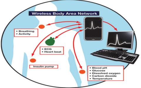 Cosè la WBAN (Wireless Body Area Network)?